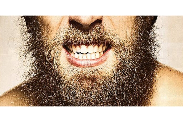 Dry Beard Causes Treatment and Prevention Tips