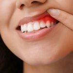 A Complete Guide to Dental Treatments in Puchong for Healthy Teeth and Gums