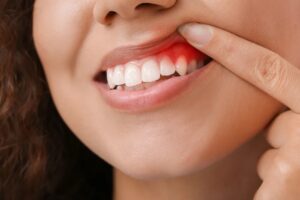A Complete Guide to Dental Treatments in Puchong for Healthy Teeth and Gums