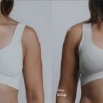How Does Mia Breast Augmentation Work? A Closer Look at the Procedure