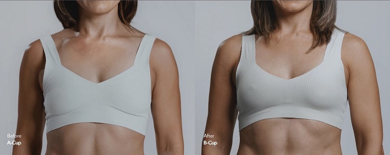 How Does Mia Breast Augmentation Work? A Closer Look at the Procedure