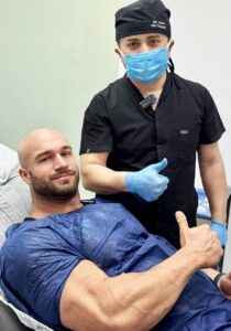 3500 Grafts Hair Transplant Before and After_ Daniel’s Journey with Dr. Resul Yaman (1)