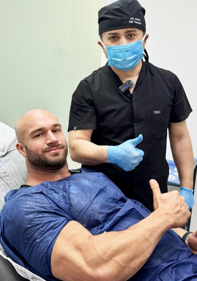 3500 Grafts Hair Transplant Before and After_ Daniel’s Journey with Dr. Resul Yaman (1)