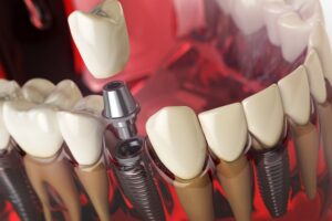 Dental (1)